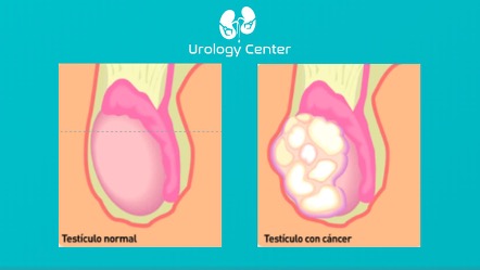 medicos urologos en guadalajara