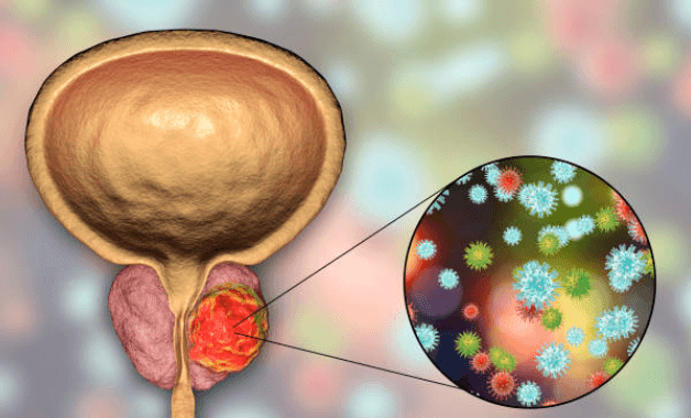 esperanza-despues-del-cancer-de-prostata